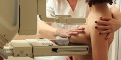 Masz 40 – 75 lat? Zg�o� si� na bezp�atn� mammografi�