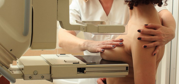 Masz 40 – 75 lat? Zgo si na bezpatn mammografi