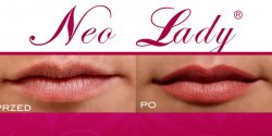 Zmys�owe usta poleca Neo Lady