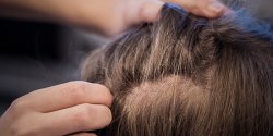 Wszawica to cz�ste zjawisko w Elbl�gu? "Bagatelizowanie problemu jest niepokoj�ce"