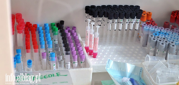 Światowy Dzień Wirusowego Zapalenia Wątroby - jak dbać o wątrobę?