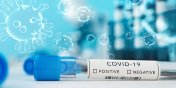 Koronawirus: Blisko tysic zgonw na COVID-19. To najwysza liczba od pocztku epidemii