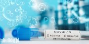 Koronawirus: Stabilnie w iloci zakae. Brak zgonw na COVID-19