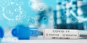 Wirusolog dla Radia ZET: W Polsce coraz więcej osób z koronawirusem, ponad 20% testów jest pozytywnych