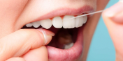 Rodzaje nici dentystycznych – ich zalety oraz wady