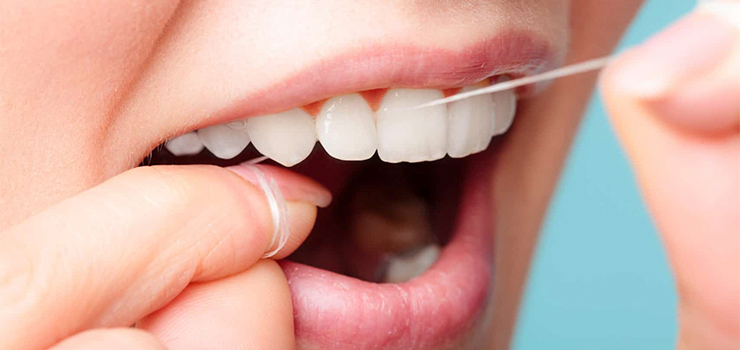 Rodzaje nici dentystycznych – ich zalety oraz wady