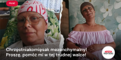 Elbl��anka walczy z rakiem. "Po ostatniej operacji przesta�am by� samodzielna"