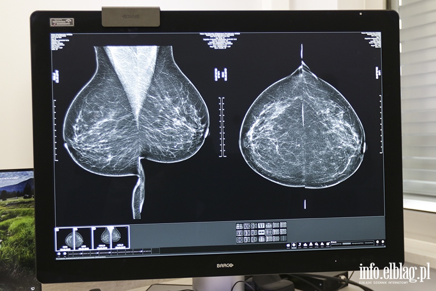 Szpital Wojewódzki-nowy mammograf, fot. 3
