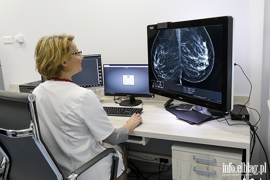 Szpital Wojewdzki-nowy mammograf, fot. 29
