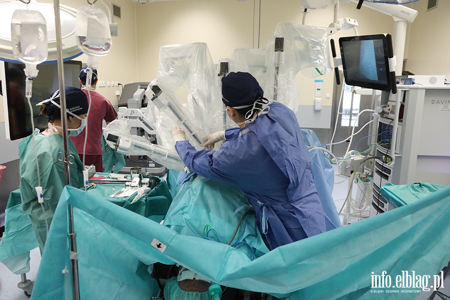 Zabieg z zakresu urologii, z wykorzystaniem robota, fot. 20