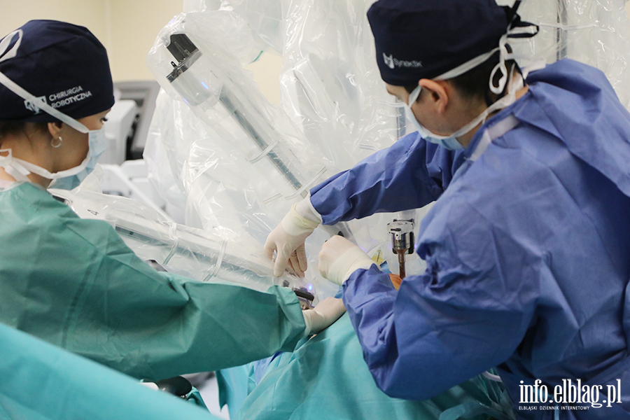 Zabieg z zakresu urologii, z wykorzystaniem robota, fot. 21