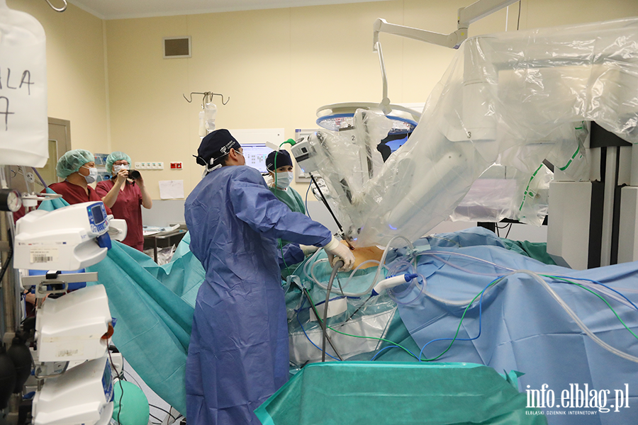 Zabieg z zakresu urologii, z wykorzystaniem robota, fot. 26