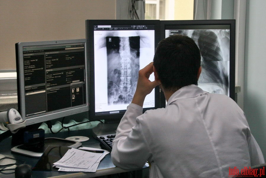 Prezentacja nowego aparatu rentgenowskiego w Zakadzie Radiologii WSzZ, fot. 16