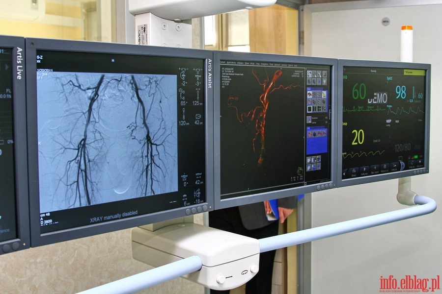 Otwarcie Pracowni Radiologii Zabiegowej w Wojewdzkim Szpitalu Zespolonym w Elblgu, fot. 4